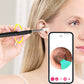 Dispositif de Nettoyage des Oreilles avec Caméra HD